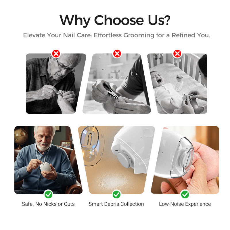 💅✨LOVILDS™Universal Automatic Fingernail for Adults and Children👶🔧