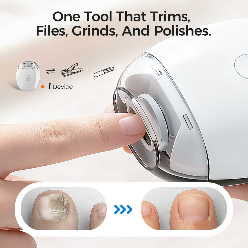 💅✨LOVILDS™Universal Automatic Fingernail for Adults and Children👶🔧